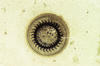 Plate 3, Figure 8, Trichodina sp.